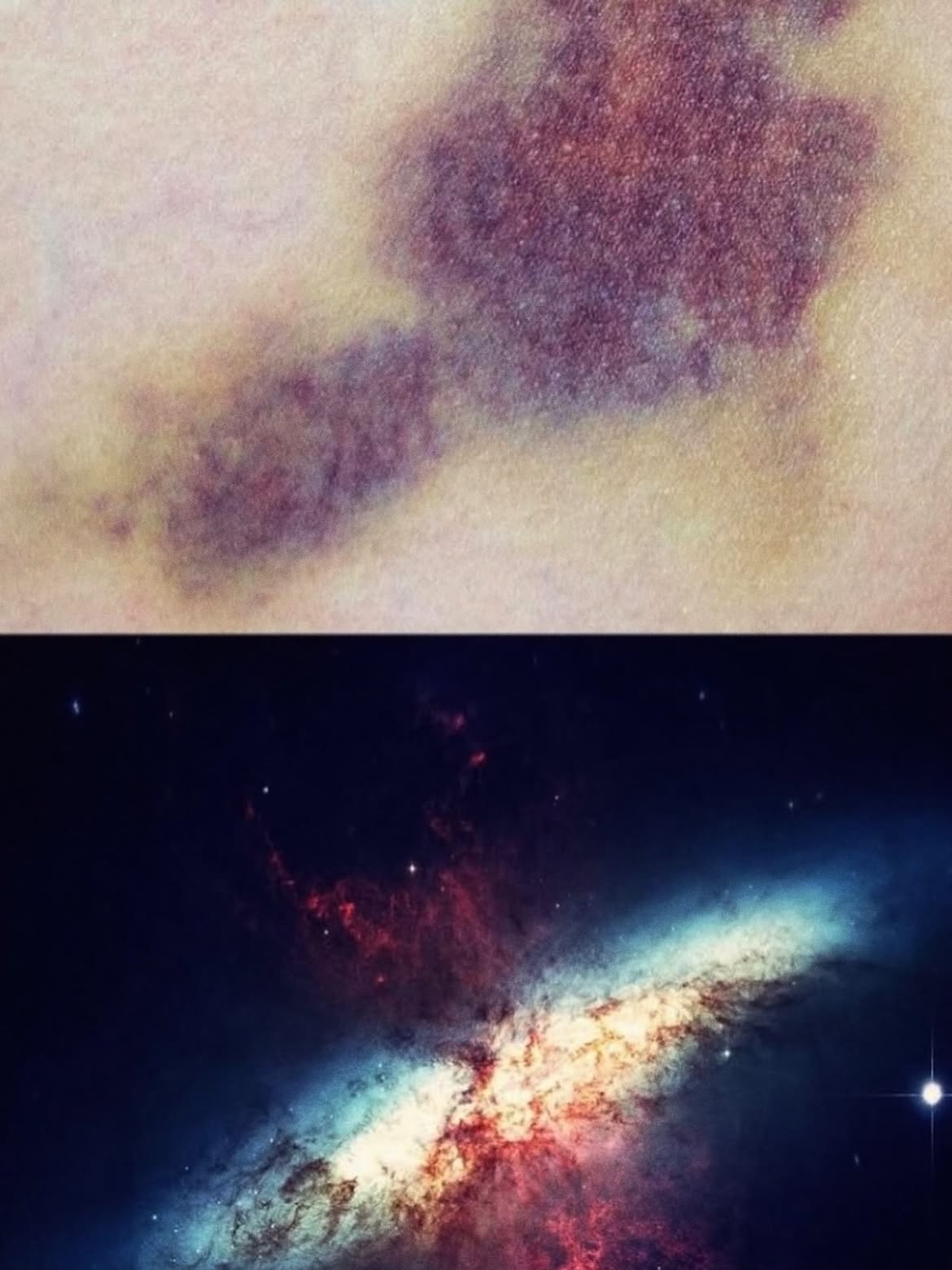 Surreal collage pairing skin with a galaxy